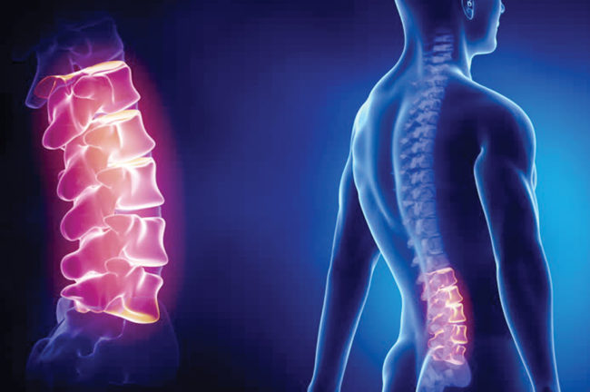 Spinal Cord বা মেরুদণ্ডের অসুখ