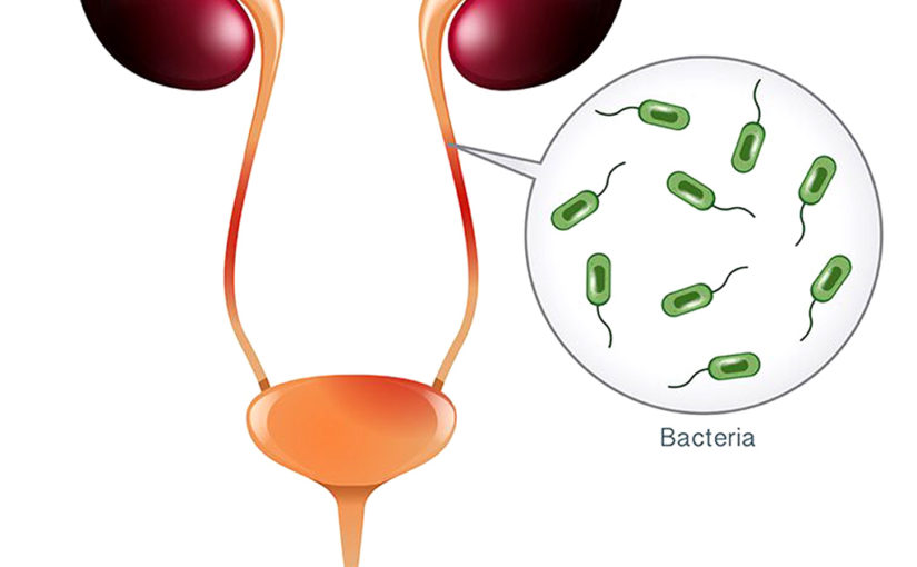 আমার বারবার ইউটিআই হয়, কী করব?