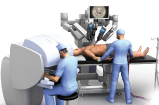 Minimal Invasive Cardiac Surgery