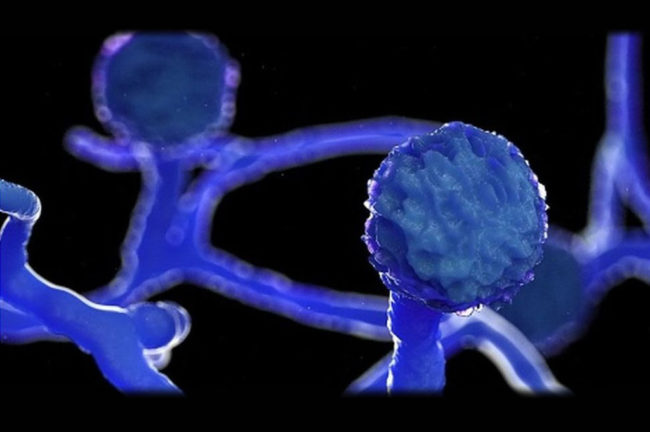 মিউকরমাইকোসিস বা ব্ল্যাক ফাঙ্গাস