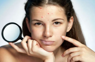 Personal problem tips on pimples
