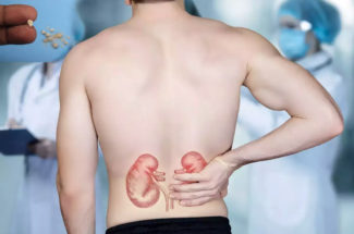 The problem of Kidney stone and it's solution