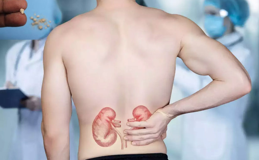 কিডনিতে পাথরের সমস্যা নিয়ে আমার স্বামী কষ্ট পাচ্ছেন