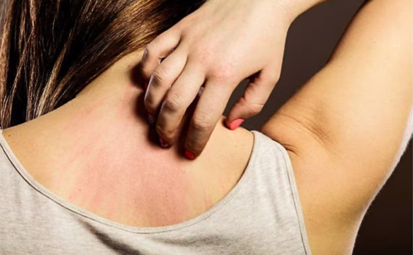 বৃষ্টির মরশুমেও পান সুন্দর ত্বক (১ম পর্ব)