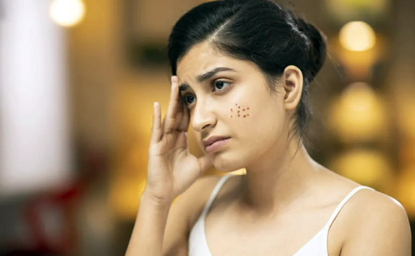 হাতে ময়েশ্চারাইজার লাগানো সত্ত্বেও ভীষণ রুক্ষ থাকে, কী করে হাত মোলায়েম রাখব?