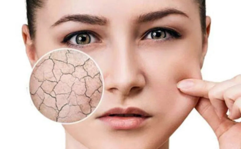 মুখে ব্ল্যাকহেডস রয়েছে, যেটি খুব সহজে নিরাময় হয় না। কী করব এই পরিস্থিতিতে?