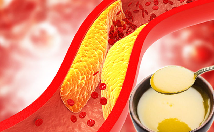 সুস্থতার জন্য চাই লোয়ার কোলেস্টেরল সমৃদ্ধ খাদ্য-উপকরণ