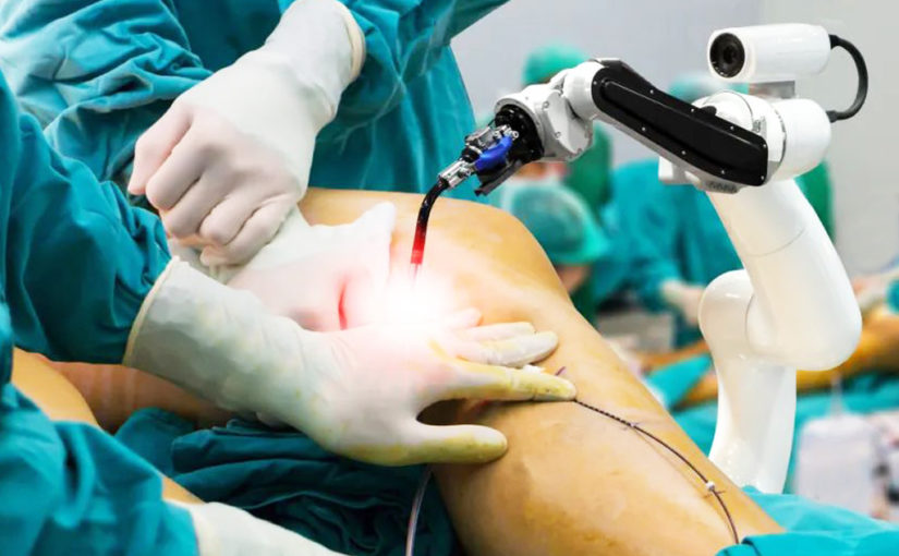 হাঁটু প্রতিস্থাপনে রোবোটিক সার্জারি