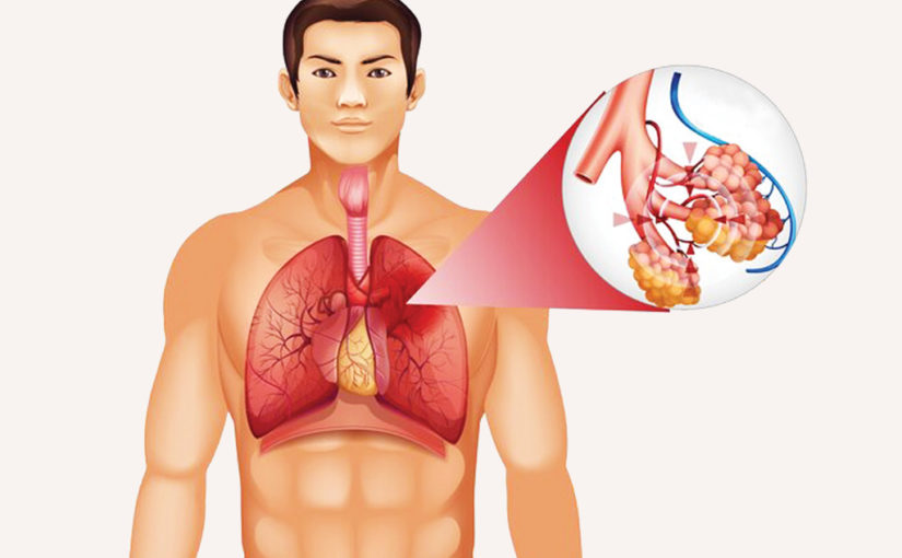 নিউমোনিয়া-র সমস্যা এবং পরিত্রাণের উপায়