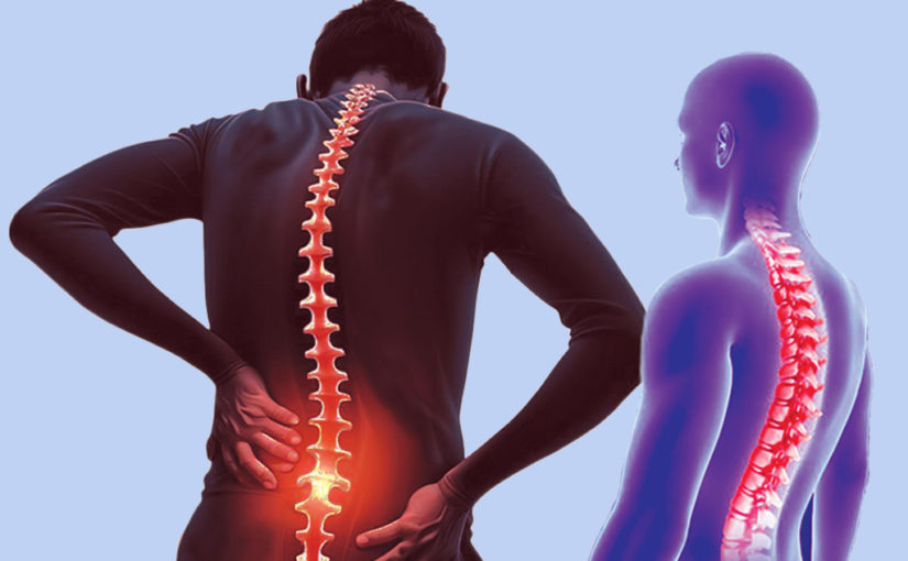 স্কোলিওসিস এবং সঠিক চিকিৎসা