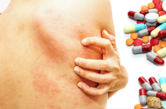 Drug Allergy-র সমস্যা এবং সতর্কতা