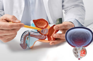 প্রস্টেট ক্যানসার-এর চিকিৎসা এবং সচেতনতা