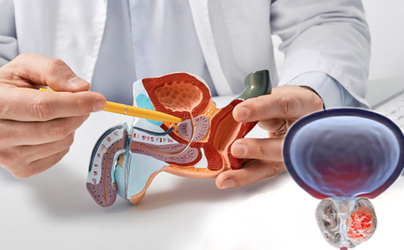 প্রস্টেট ক্যানসার-এর চিকিৎসা এবং সচেতনতা